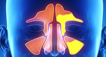 Sinuses anatomy in 3D