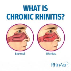 What is Chronic Rhinitis